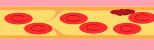 ʲôL(fng)